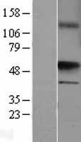 uronyl 2 sulfotransferase (UST) Human Over-expression Lysate