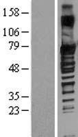 SOX13 Human Over-expression Lysate