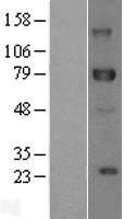 DLL1 Human Over-expression Lysate