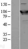 PYGM Human Over-expression Lysate
