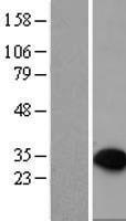 PTPRCAP Human Over-expression Lysate