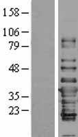 IFI35 Human Over-expression Lysate