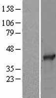 SAE1 Human Over-expression Lysate