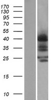 CCR4 Human Over-expression Lysate