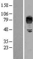 LIMPII (SCARB2) Human Over-expression Lysate