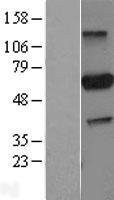 PARP3 Human Over-expression Lysate
