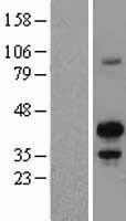 MAFB Human Over-expression Lysate