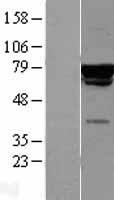 p60 CAF1 (CHAF1B) Human Over-expression Lysate