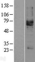 PODXL Human Over-expression Lysate