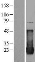 p21 Ras (HRAS) Human Over-expression Lysate
