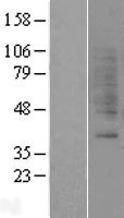 GRPR Human Over-expression Lysate