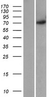 GRK5 Human Over-expression Lysate