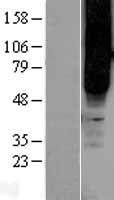 GPR43 (FFAR2) Human Over-expression Lysate