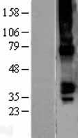 GJA5 Human Over-expression Lysate