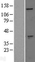GAK Human Over-expression Lysate
