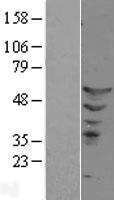 ETS2 Human Over-expression Lysate