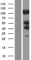 CBL Human Over-expression Lysate