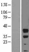 BMI1 Human Over-expression Lysate