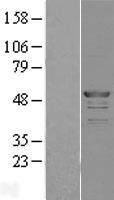ATOH1 Human Over-expression Lysate