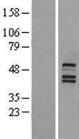 Bile Acid Receptor (NR1H4) Human Over-expression Lysate