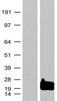 RAC3 Human Over-expression Lysate