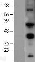 MMP14 Human Over-expression Lysate