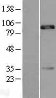 CDH18 Human Over-expression Lysate