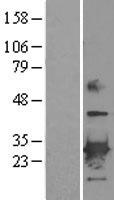 Peroxiredoxin 6 (PRDX6) Human Over-expression Lysate