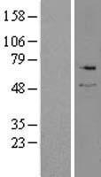Serine Palmitoyltransferase (SPTLC2) Human Over-expression Lysate