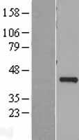 VPS26 (VPS26A) Human Over-expression Lysate