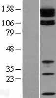 TJP2 Human Over-expression Lysate