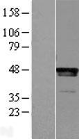 LHX2 Human Over-expression Lysate