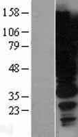 HGS Human Over-expression Lysate