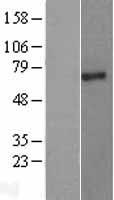 PIAS2 Human Over-expression Lysate
