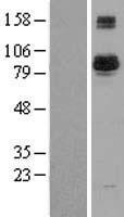 BAP1 Human Over-expression Lysate