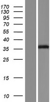 Thymidine Kinase 2 (TK2) Human Over-expression Lysate