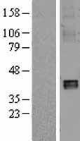 NDUFA10 Human Over-expression Lysate
