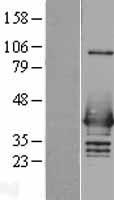 HNRNPC Human Over-expression Lysate