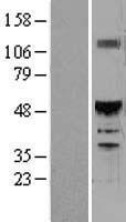 HNF6 (ONECUT1) Human Over-expression Lysate