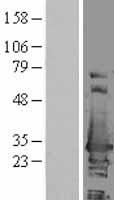 ERAB (HSD17B10) Human Over-expression Lysate