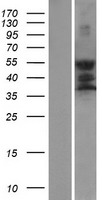 GPS2 Human Over-expression Lysate