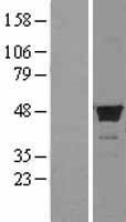 FDFT1 Human Over-expression Lysate