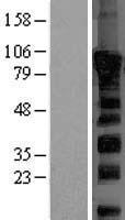 Dishevelled 2 (DVL2) Human Over-expression Lysate