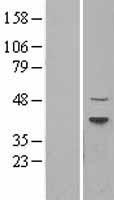 Dnmt2 (TRDMT1) Human Over-expression Lysate