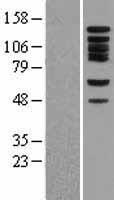 BUB1 Human Over-expression Lysate