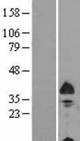 BNIP3L Human Over-expression Lysate