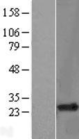 RHOH Human Over-expression Lysate