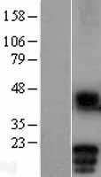 MD1 (LY86) Human Over-expression Lysate