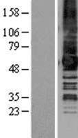 Melatonin Related Receptor (GPR50) Human Over-expression Lysate