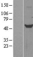 Tryptophan Hydroxylase (TPH1) Human Over-expression Lysate